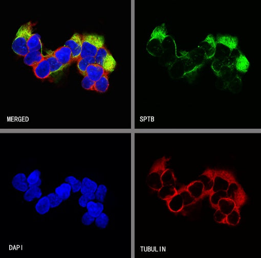 SPTB Recombinant Rabbit mAb (S-755-63)