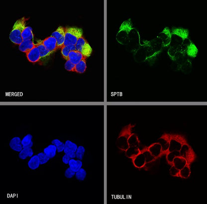 SPTB Recombinant Rabbit mAb (S-755-63)