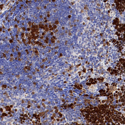 CDK1 Recombinant Rabbit mAb (S-1374-66)