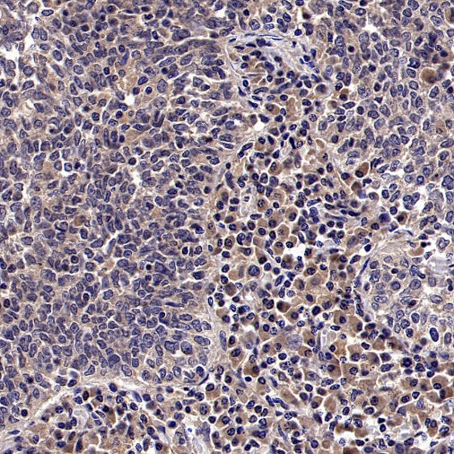 CK1α Recombinant Rabbit mAb (SDT-2884-60)