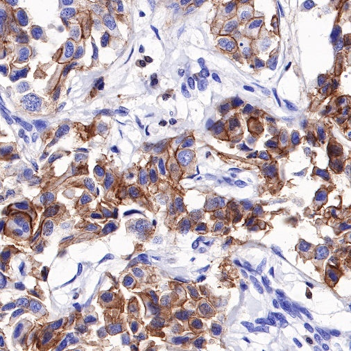Stat5 Recombinant Rabbit mAb (S-R234)