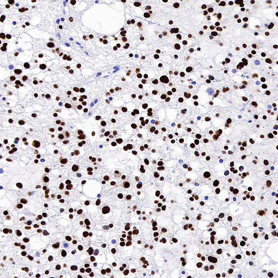 SOX2 Recombinant Rabbit mAb (S-5000)