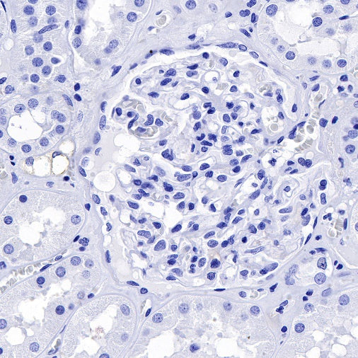 S-RMab® Desmin Recombinant Rabbit mAb (SDT-109-114)