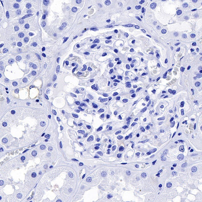 S-RMab® Desmin Recombinant Rabbit mAb (SDT-109-114)