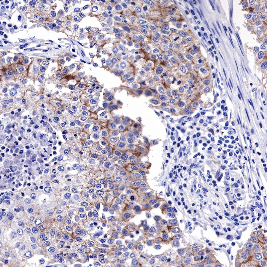 EGFR Recombinant Rabbit mAb (SDT-R110)