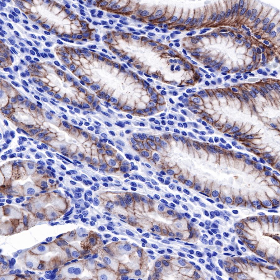Claudin18.2 Recombinant Rabbit mAb,PBS Only (SDT-102-24)