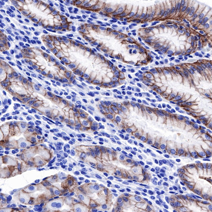Claudin18.2 Recombinant Rabbit mAb,PBS Only (SDT-102-24)