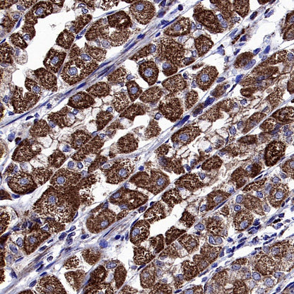 DLST Rabbit Polyclonal Antibody