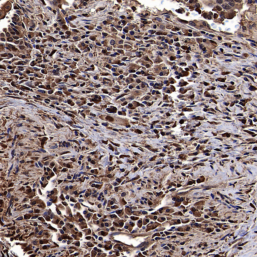 ALDOA Mouse mAb