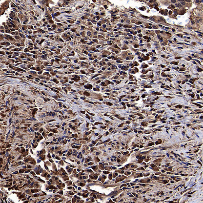 ALDOA Mouse mAb