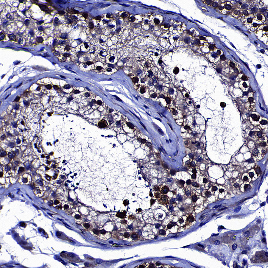 Upf1 Rabbit Polyclonal Antibody