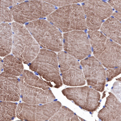 alpha-actinin-2 Recombinant Rabbit mAb (SDT-032-79)
