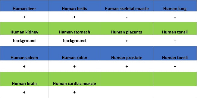 KDM6A Recombinant Rabbit mAb (S-1728-51)