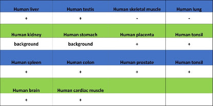 KDM6A Recombinant Rabbit mAb (S-1728-51)
