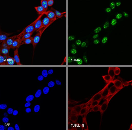 KDM4A Recombinant Rabbit mAb (S-957-138)
