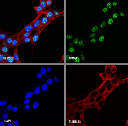 KDM4A Recombinant Rabbit mAb (S-957-138)