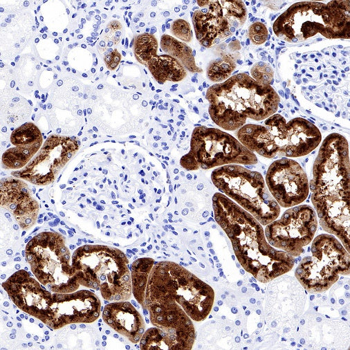 CHI3L1 Recombinant Rabbit mAb (S-324-38)