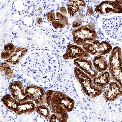 CHI3L1 Recombinant Rabbit mAb (S-324-38)