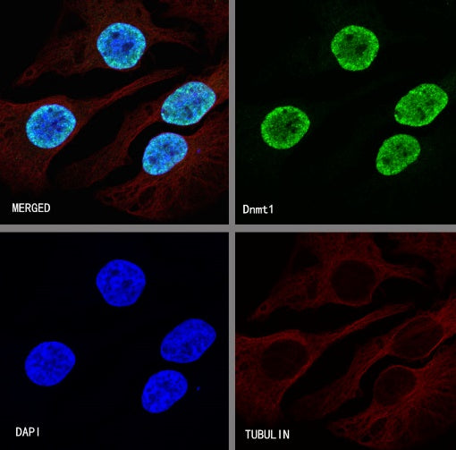 Dnmt1 Recombinant Rabbit mAb (S-R324)
