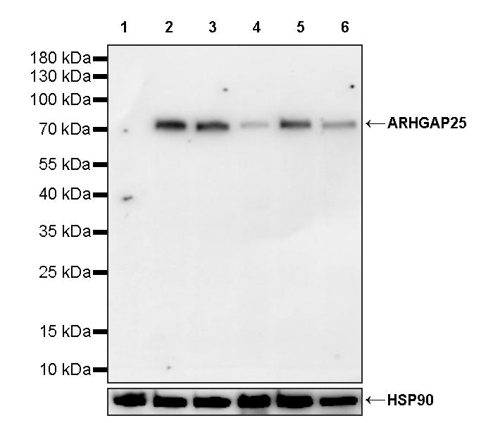 ARHGAP25 Recombinant Rabbit mAb (S-4005-5)