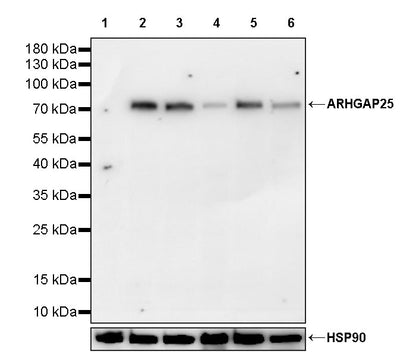 ARHGAP25 Recombinant Rabbit mAb (S-4005-5)