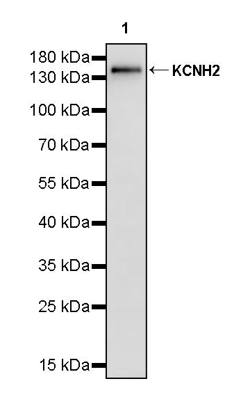 KCNH2 Recombinant Rabbit mAb (S-3727-63)