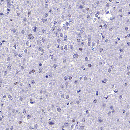ROR beta/RORB Recombinant Rabbit mAb (S-5483)