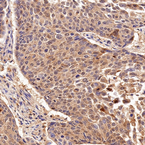Superoxide Dismutase 1 Recombinant Rabbit mAb (S-1537-39)