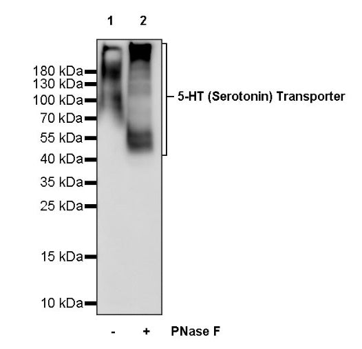 5-HT (Serotonin) Transporter Recombinant Rabbit mAb (S-1332-21)