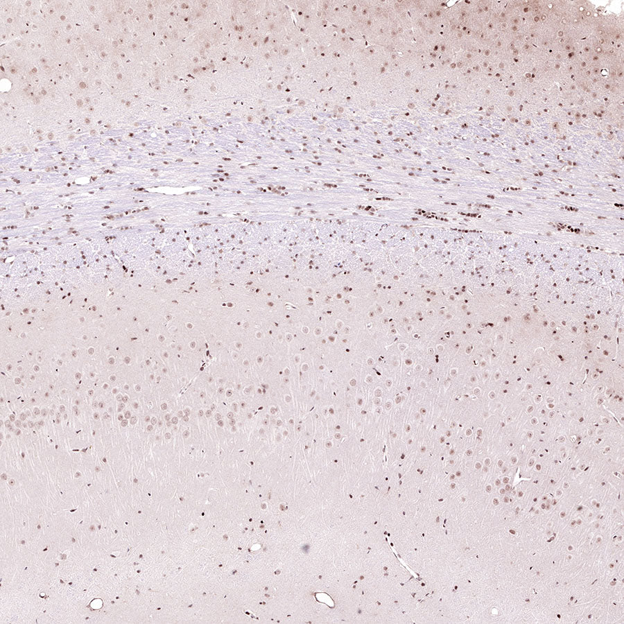 Acetyllysine Recombinant Rabbit mAb (SDT-R096)