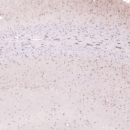Acetyllysine Recombinant Rabbit mAb (SDT-R096)