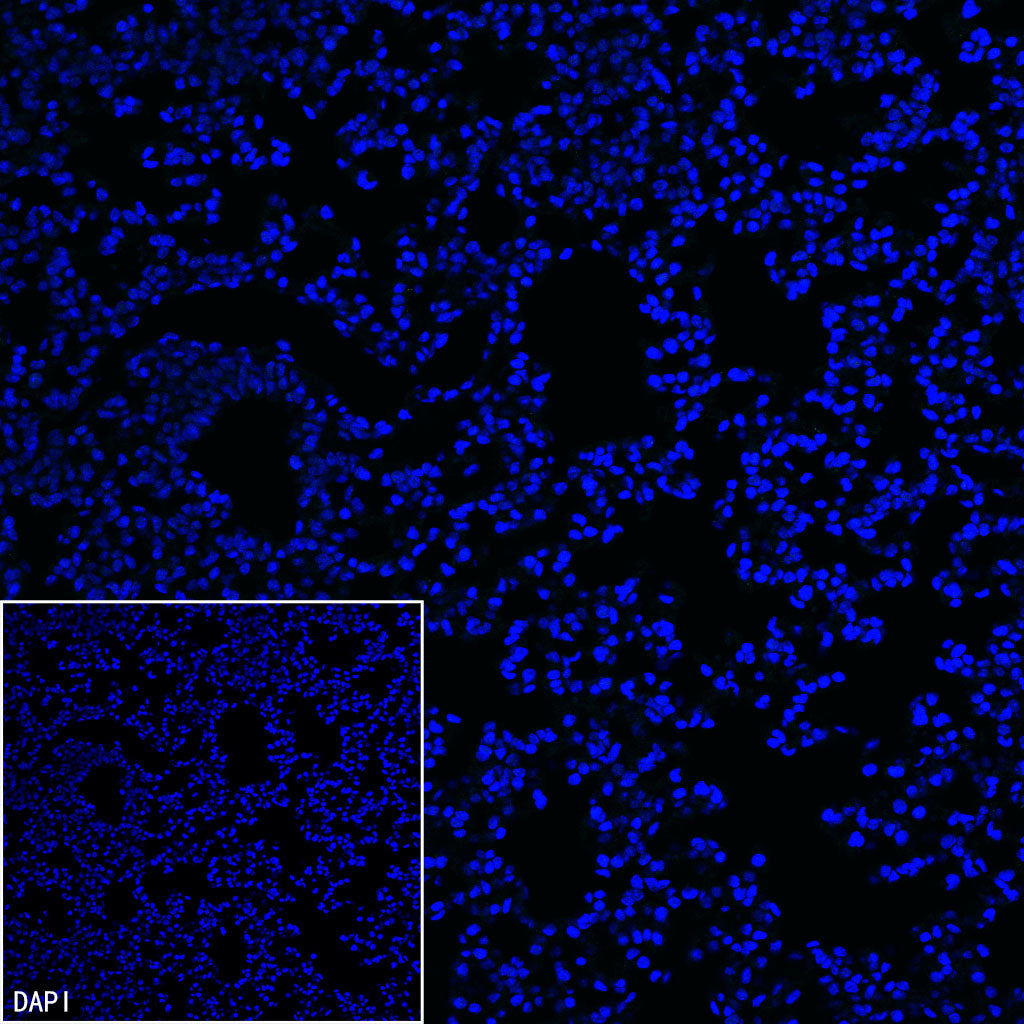Homer1 Recombinant Rabbit mAb (S-3405-360)