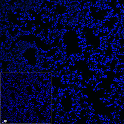 Homer1 Recombinant Rabbit mAb (S-3405-360)