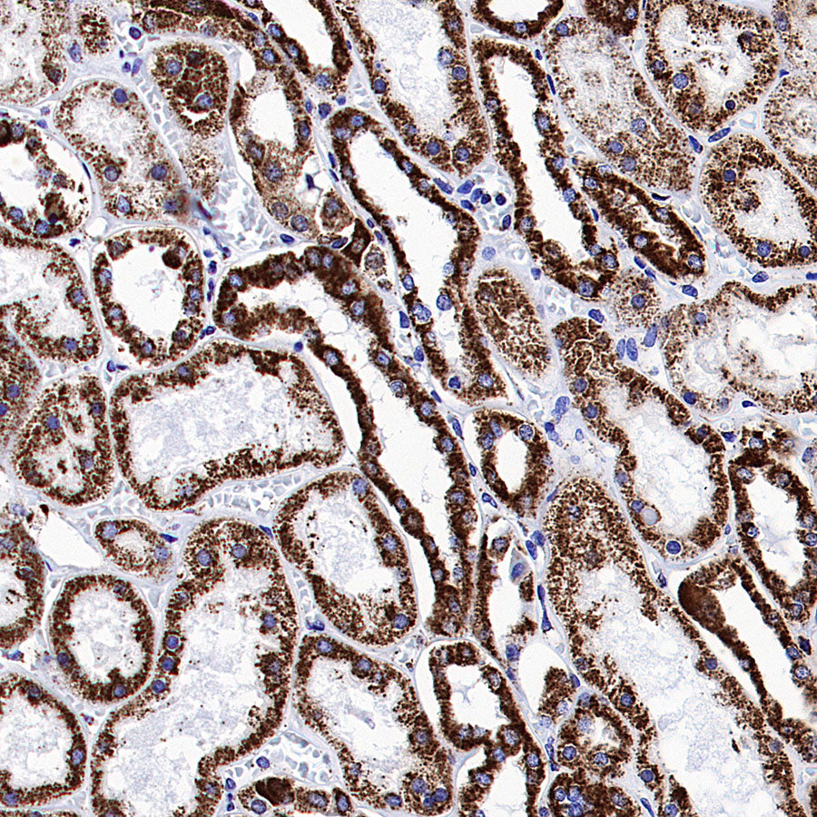 ATPIF1 Recombinant Rabbit mAb (S-3849-49)