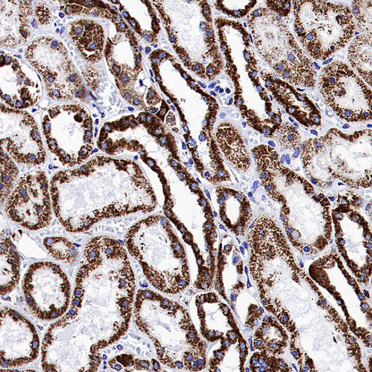 ATPIF1 Recombinant Rabbit mAb (S-3849-49)