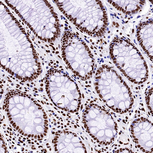 HDAC2 Recombinant Rabbit mAb (S-1474-27)
