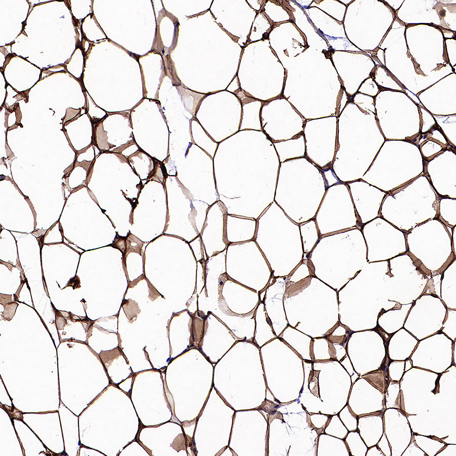 PNPLA2 Recombinant Rabbit mAb (S-5409)