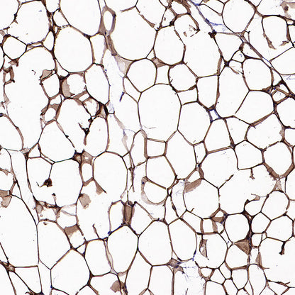 PNPLA2 Recombinant Rabbit mAb (S-5409)