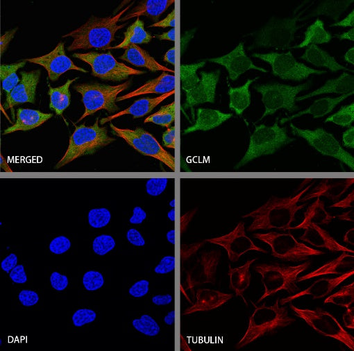 GCLM Recombinant Rabbit mAb (S-2209-19)