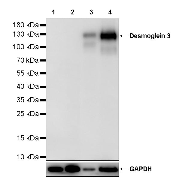 Desmoglein 3 Recombinant Rabbit mAb (SDT-3213-33)