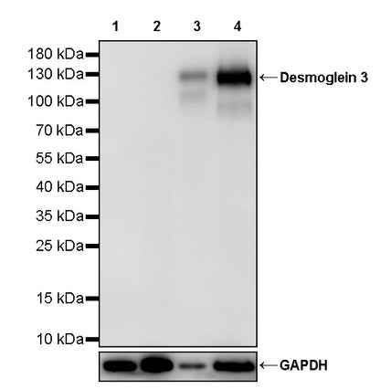 Desmoglein 3 Recombinant Rabbit mAb (SDT-3213-33)