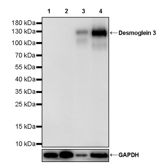 Desmoglein 3 Recombinant Rabbit mAb (SDT-3213-33)