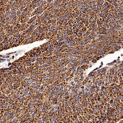 ATPB Rabbit Polyclonal Antibody
