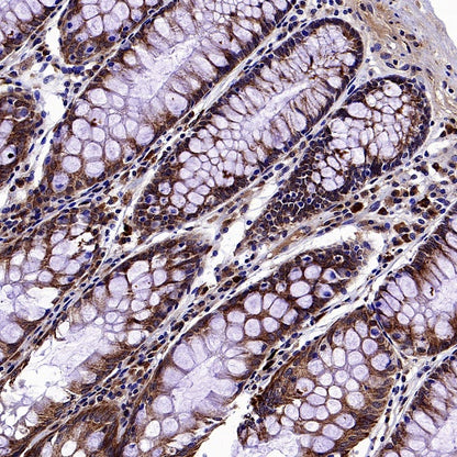 GPD2 Recombinant Rabbit mAb (S-2941-41)