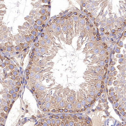 TBK1/NAK Recombinant Rabbit mAb (S-658-50)