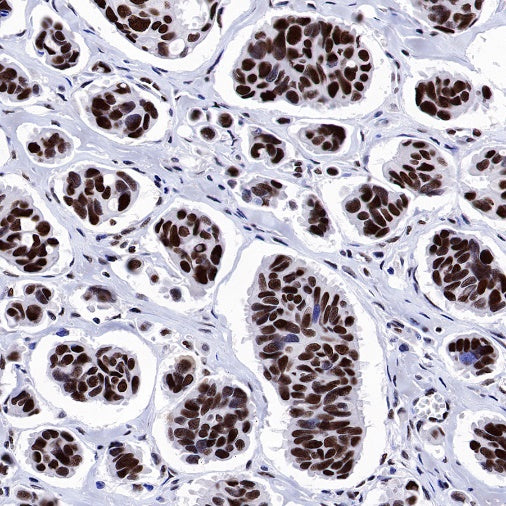 NuMA Recombinant Rabbit mAb (SDT-474-241)
