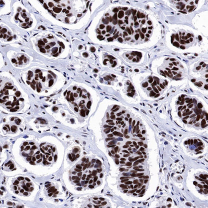 NuMA Recombinant Rabbit mAb (SDT-474-241)