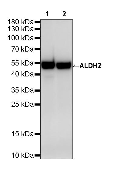 ALDH2 Recombinant Rabbit mAb (S-4173-20)