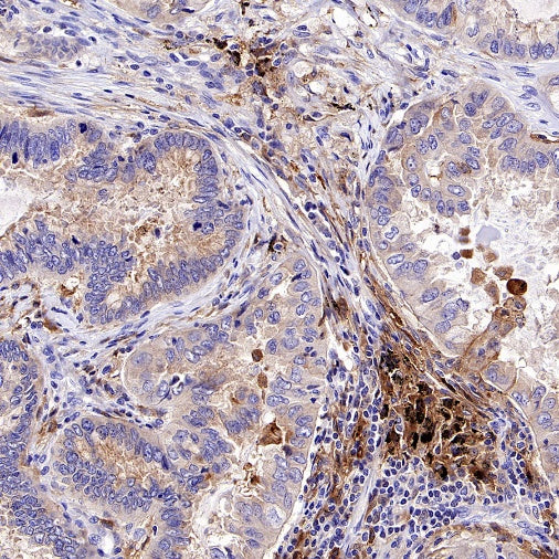 TLR2 Recombinant Rabbit mAb (S-2585-57)