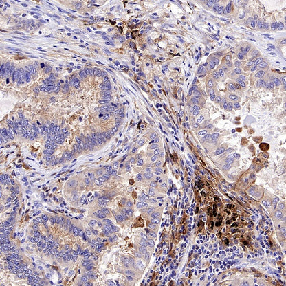 TLR2 Recombinant Rabbit mAb (S-2585-57)